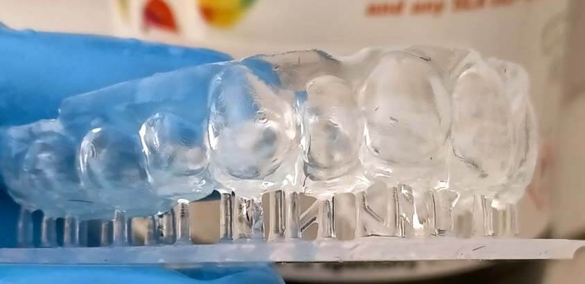 Alineadores dentales de impresión directa con 3DResyn OD Clear TF, ¡sorprendente!